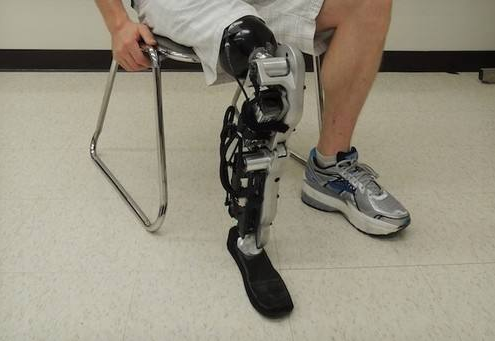 淺談膝關節對大腿截肢具有哪些重要性(圖1) 淺談膝關節對大腿截肢具有哪些重要性(圖1)