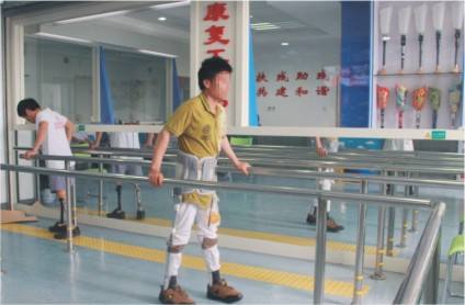 給兒童進行安裝假肢時要注意什么(圖1) 給兒童進行安裝假肢時要注意什么(圖1)