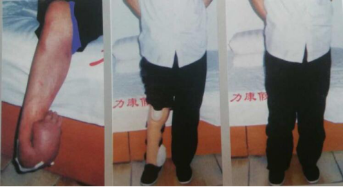 張海迪:郝趁義你穿假肢跟正常人一樣(圖3) 張海迪:郝趁義你穿假肢跟正常人一樣(圖3)