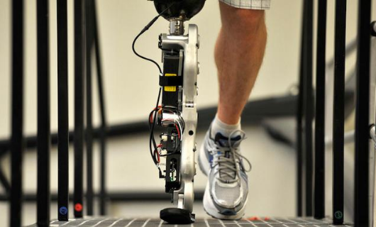 假肢廠家淺談購買假肢常見的幾大誤區(圖1) 假肢